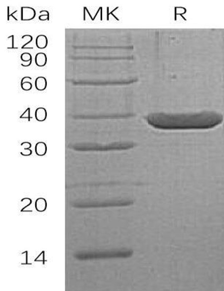 Human LDH-A/LDHA Recombinant Protein (RPES3651)