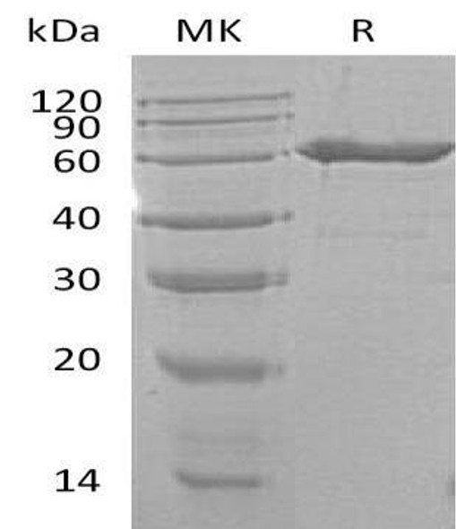 Mouse CD73/NT5E Recombinant Protein (RPES3669)