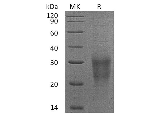 Human NKG2D/CD314 Recombinant Protein (RPES3681)