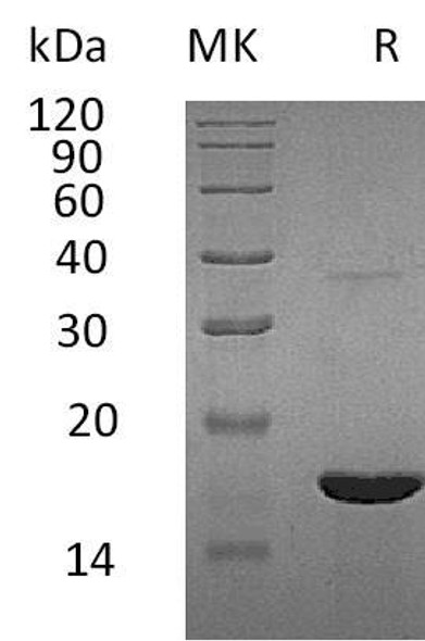 Human REG3G/PAPB Recombinant Protein (RPES3697)