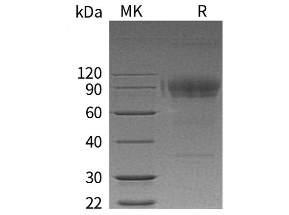 Human IL2RG/CD132 Recombinant Protein (RPES3703)