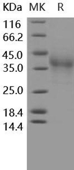 Human PD/PDCD1 Recombinant Protein (RPES3730)