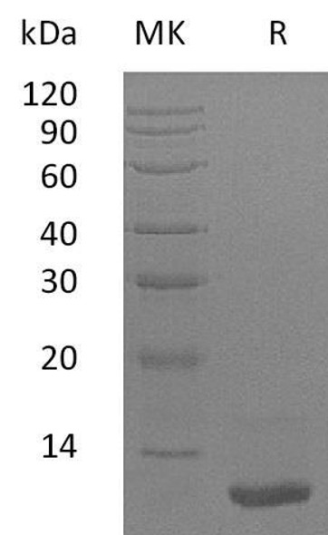 Human LR3-IGF Recombinant Protein (MG) (RPES3738)