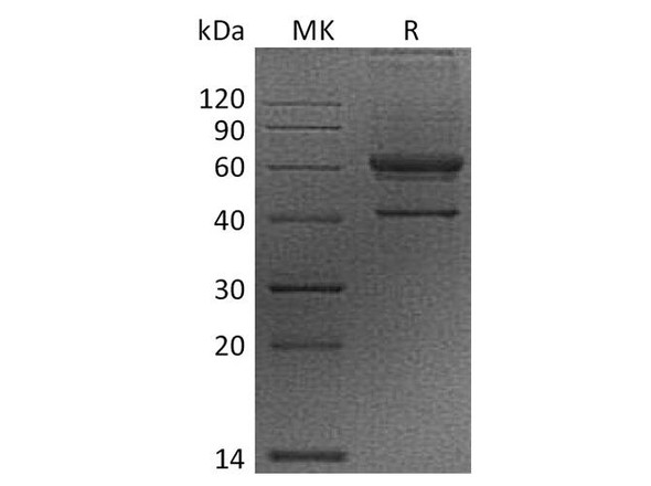 Human VEGF-B/VEGFB Recombinant Protein (RPES3768)