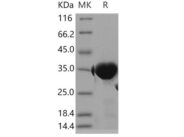 Human GPD1/GDP-C Recombinant Protein (RPES3771)