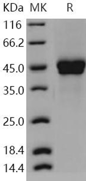 Human PTX3/Pentraxin 3/TSG4 Recombinant Protein (RPES3772)