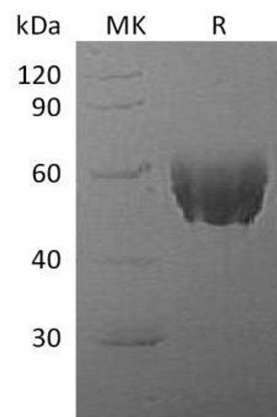 Mouse Fetuin-A/AHSG Recombinant Protein (RPES3785)