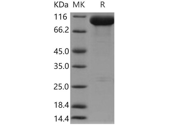 Mouse PSMA/FOLH1 Recombinant Protein (RPES3798)