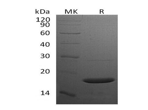 Mouse alpha-Synuclein/SNCA Recombinant Protein (RPES3807)