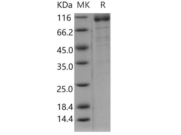 Human ILT6/LILRA3 Recombinant Protein (RPES3820)