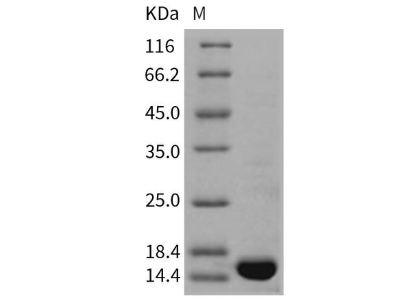 Rat TNF-alpha/TNFA Recombinant Protein  (RPES3826)