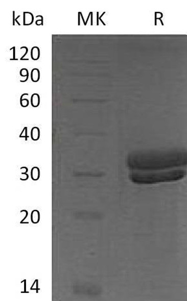 Mouse Kallikrein 7/KLK7 Recombinant Protein (RPES3839)