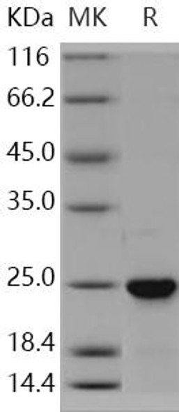 Human NRAS Recombinant Protein (RPES3857)