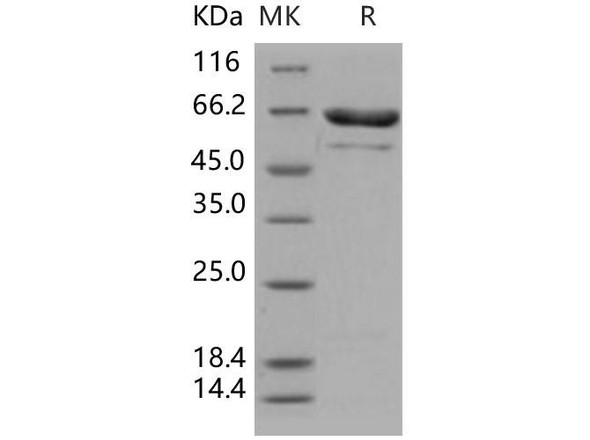 Human PRMT5/SKB1 Recombinant Protein (RPES3858)
