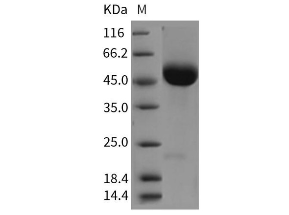 Rat CD5 Recombinant Protein (RPES3860)