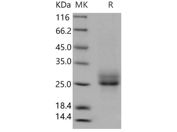 Human RELT/TNFRSF19L Recombinant Protein (RPES3864)