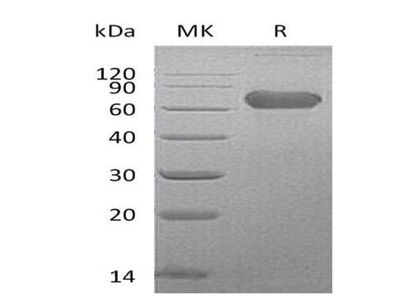 Human LTBR/TNFRSF3 Recombinant Protein (RPES3867)