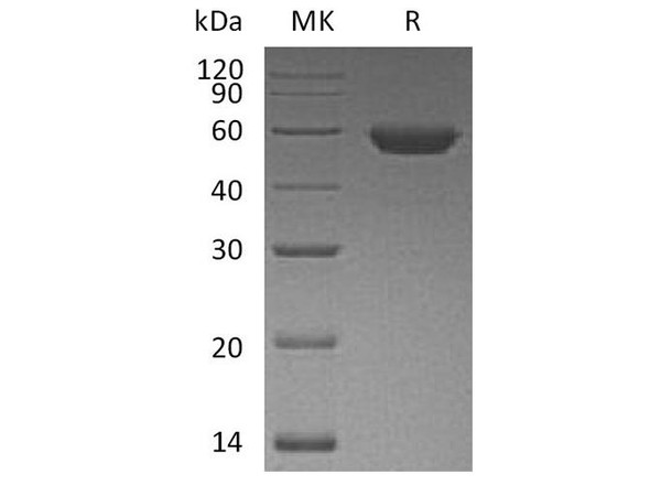 Human ROR2 Recombinant Protein (RPES3876)