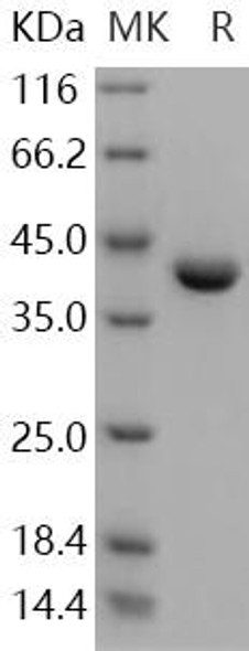 Human Pepsinogen C/PGC Recombinant Protein (RPES3880)