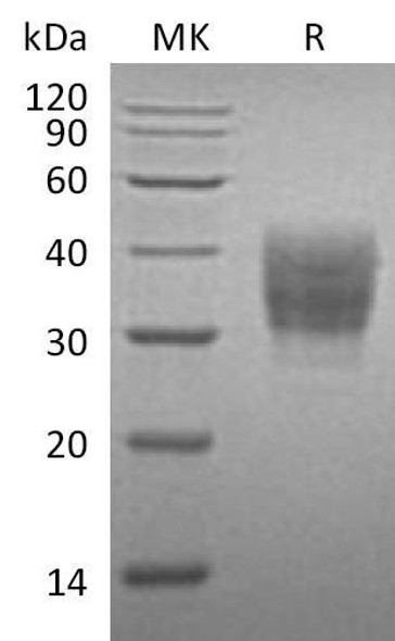 Mouse SLAMF7/CD319 Recombinant Protein (RPES3907)