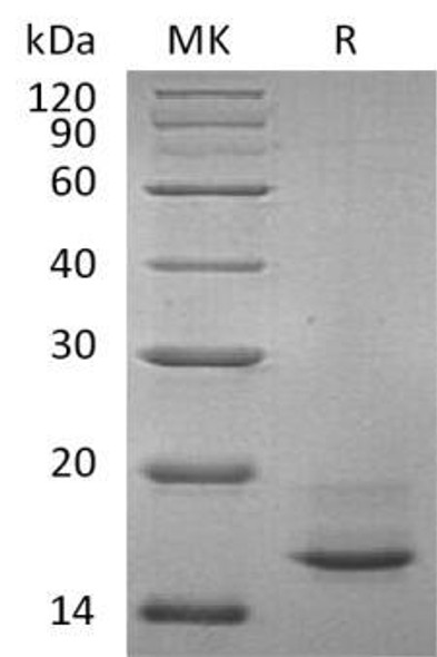 Human Calcitonin/CALCA Recombinant Protein (RPES3910)