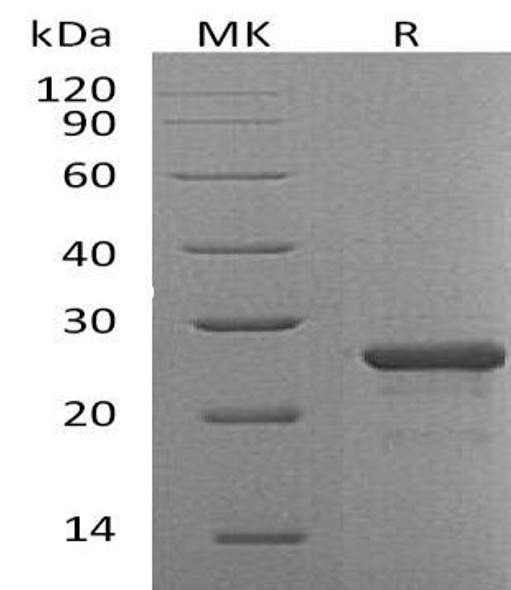 Human FGF9/FGF9 Recombinant Protein (RPES3911)