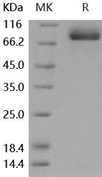 Mouse MEP1A/PPHA Recombinant Protein (RPES3915)