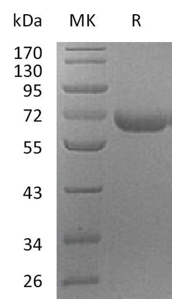 Human PRCP Recombinant Protein (RPES3934)