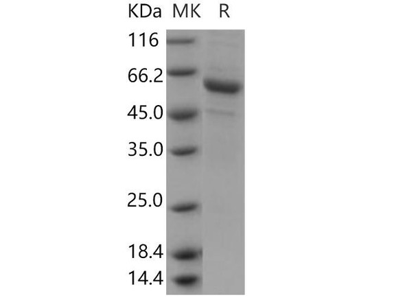 Human PSG6/PSG10 Recombinant Protein (RPES3944)