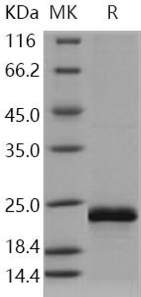 Human HRAS/GTPase Hras Recombinant Protein (RPES3945)