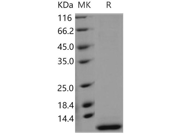 Human SMR3B Recombinant Protein (RPES3951)