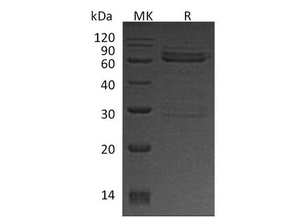 Human CAMK1D Recombinant Protein (RPES3985)