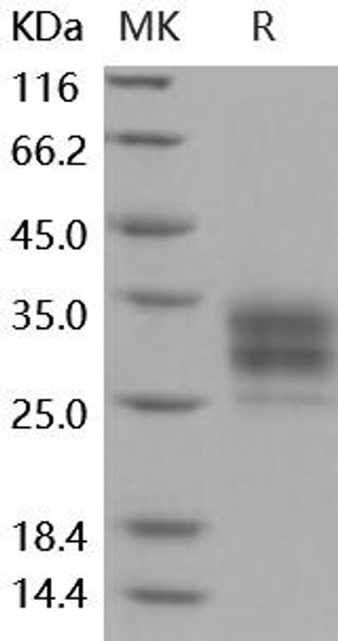 Mouse CD16-2/FCGR4 Recombinant Protein (RPES4001)