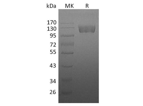 Human CSF1R/CD115 Recombinant Protein (RPES4019)