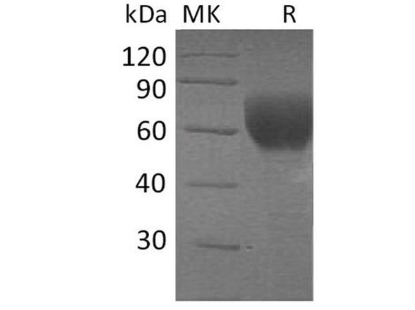 Human TGFBR2 Recombinant Protein (RPES4049)