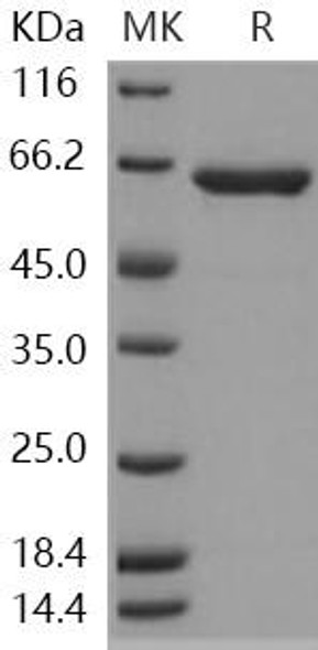 Human HEXA Recombinant Protein (RPES4054)