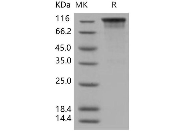 Human TIM1/HAVCR1 Recombinant Protein (RPES4079)