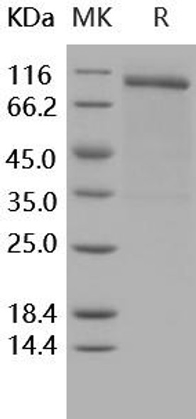 Human Nogo Receptor/NgR Recombinant Protein (RPES4085)