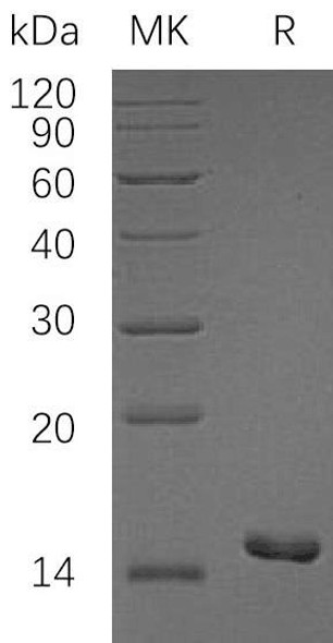 Human PKIB/PKI-Beta Recombinant Protein (RPES4086)