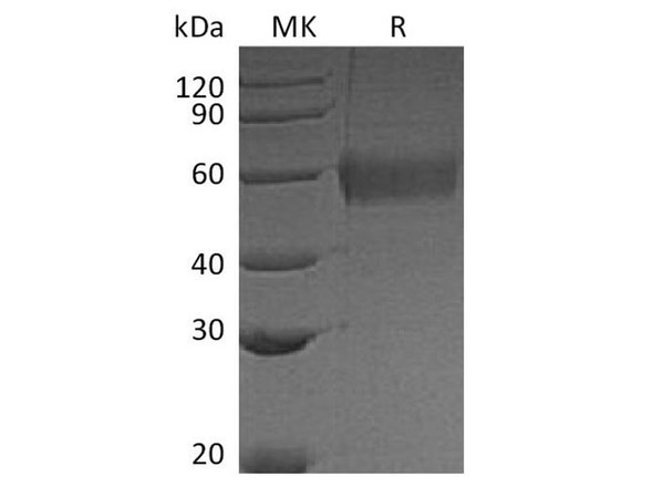 Soluble IFN alpha/beta Receptor Recombinant Protein (RPES4124)