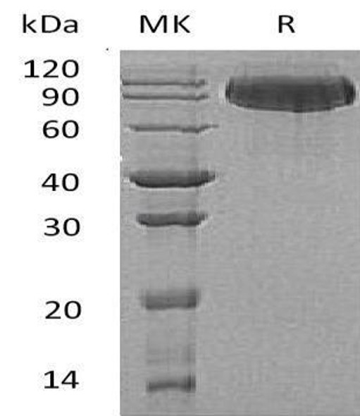 Butyrylcholinesterase/BCHE Recombinant Protein (RPES4126)