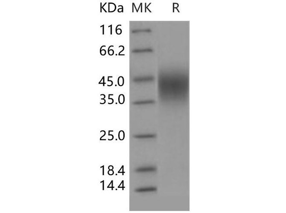 Human CD16b/FCGR3B Recombinant Protein (RPES4150)