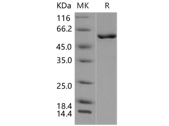 Mouse CAMK4/CaMKIV Recombinant Protein (RPES4153)
