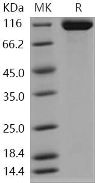 Human RET Kinase Recombinant Protein (RPES4173)