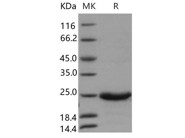 Human GM2A Recombinant Protein (RPES4179)