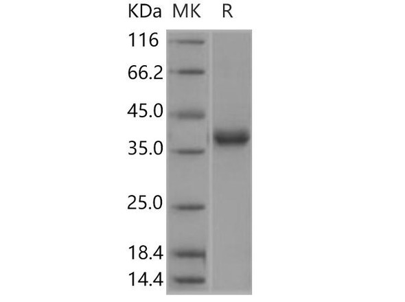 Glutaminyl cyclase/QPCT Recombinant Protein (RPES4196)