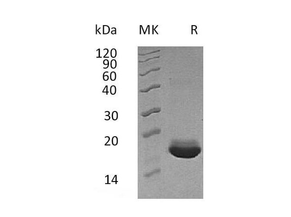 Human MANF/ARMET Recombinant Protein (RPES4207)