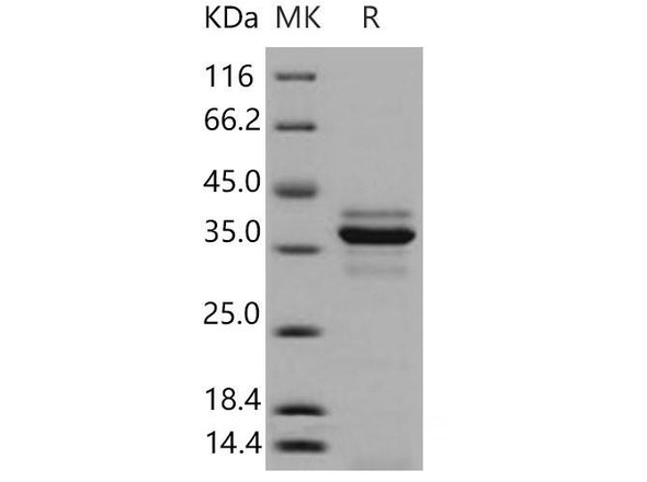 Mouse Cathepsin L/CTSL Recombinant Protein (RPES4210)