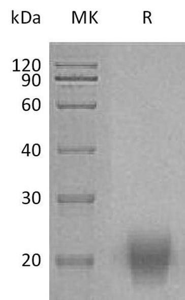 Human FSH Recombinant Protein (RPES4230)