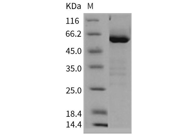 Rat CD73/NT5E Recombinant Protein (RPES4248)